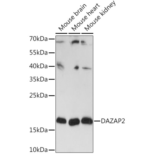 DAZAP2 Rabbit pAb