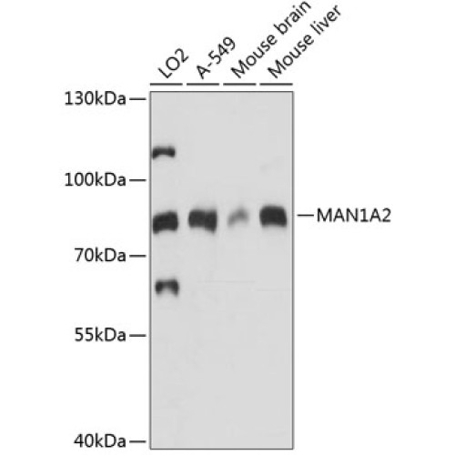 MAN1A2 Rabbit pAb