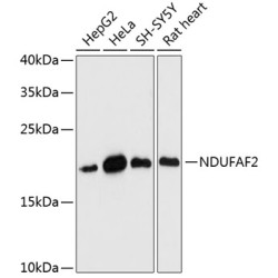 NDUFAF2 Rabbit pAb