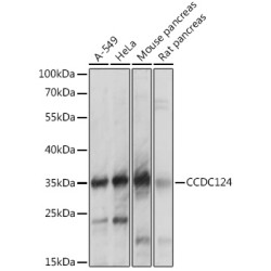 CCDC124 Rabbit pAb