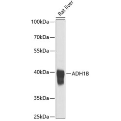 ADH1B Rabbit pAb