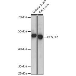 KCNJ12 Rabbit pAb