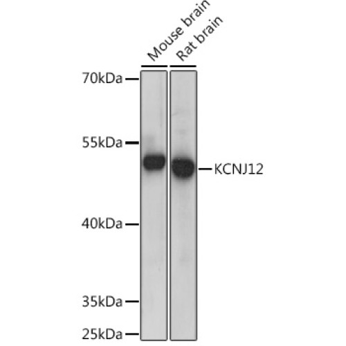 KCNJ12 Rabbit pAb