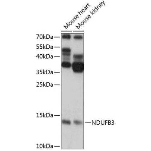 NDUFB3 Rabbit pAb