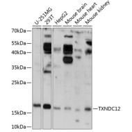TXNDC12 Rabbit pAb