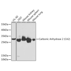 Carbonic Anhydrase 2 (CA2) Rabbit pAb