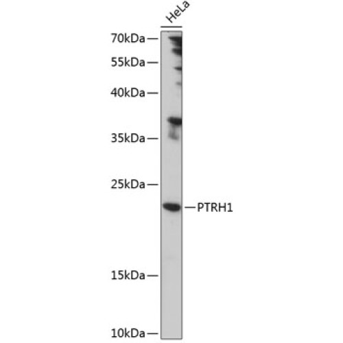 PTRH1 Rabbit pAb
