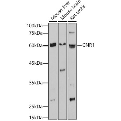 CNR1 Rabbit pAb