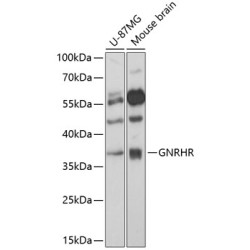 GNRHR Rabbit pAb