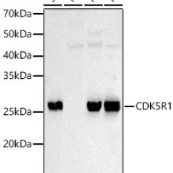 CDK5R1 Rabbit pAb