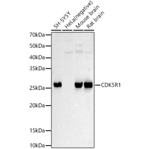 CDK5R1 Rabbit pAb