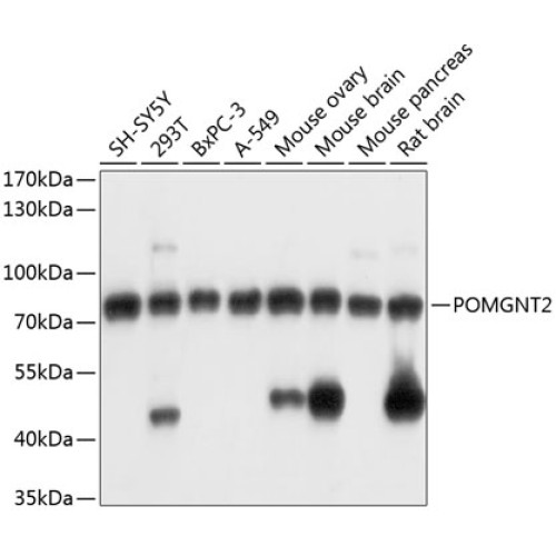 POMGNT2 Rabbit pAb