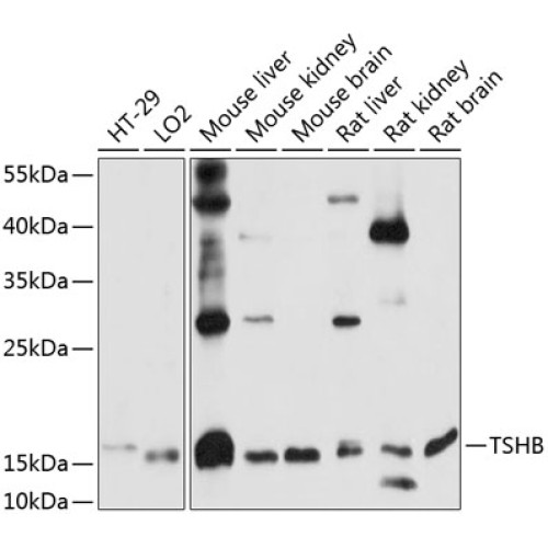 TSHB Rabbit pAb