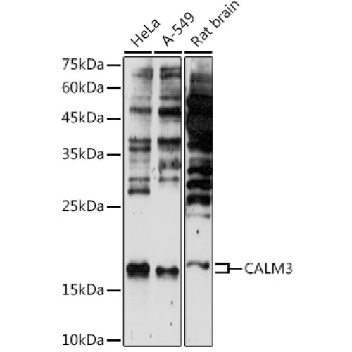 CALM3 Rabbit pAb