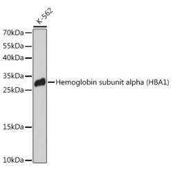 Hemoglobin subunit alpha (HBA1) Rabbit pAb