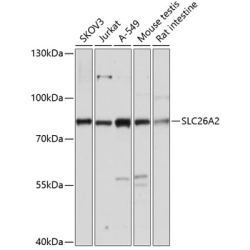 SLC26A2 Rabbit pAb