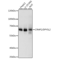 [KO Validated] CRMP2/DPYSL2 Rabbit pAb