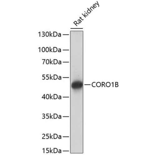 CORO1B Rabbit pAb