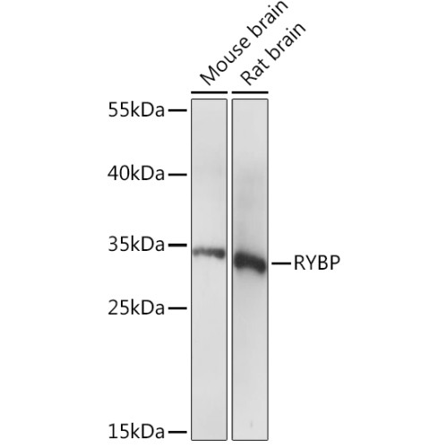 RYBP Rabbit pAb