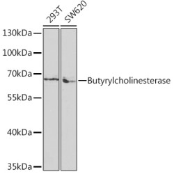 Butyrylcholinesterase Rabbit pAb