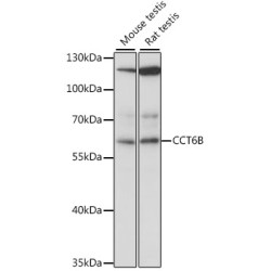CCT6B Rabbit pAb