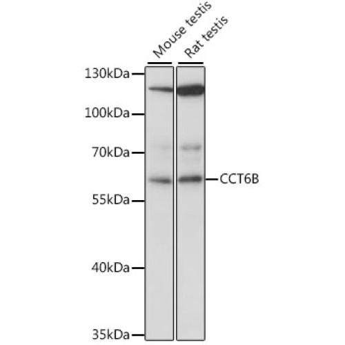 CCT6B Rabbit pAb