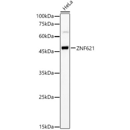 ZNF621 Rabbit pAb