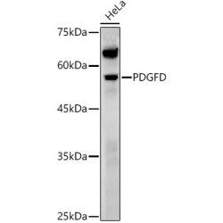 PDGFD Rabbit pAb