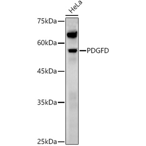 PDGFD Rabbit pAb