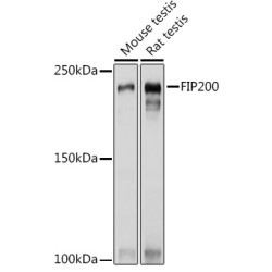 FIP200 Rabbit pAb