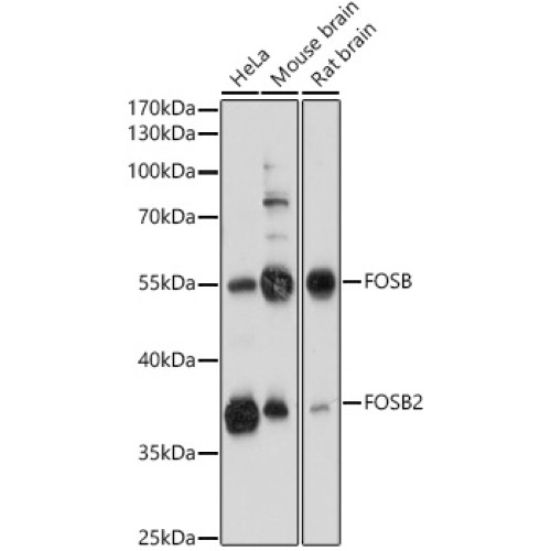 FOSB Rabbit pAb