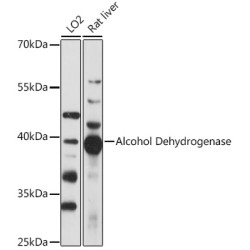 Alcohol Dehydrogenase Rabbit pAb