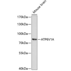 ATP6V1A Rabbit pAb