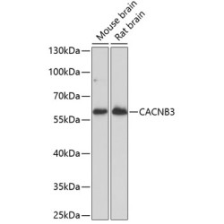CACNB3 Rabbit pAb