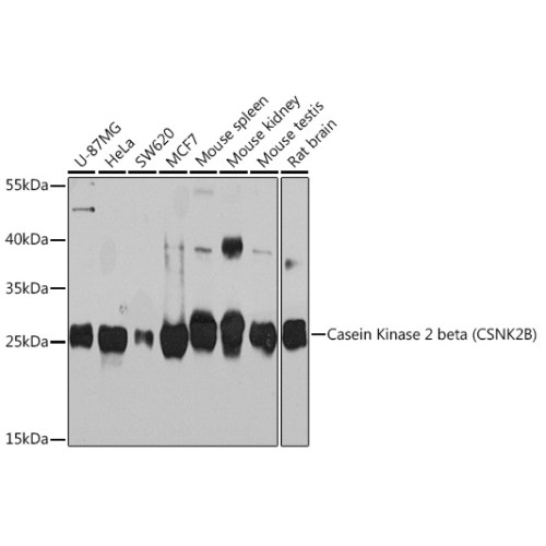 Casein Kinase 2 beta (CSNK2B) Rabbit pAb