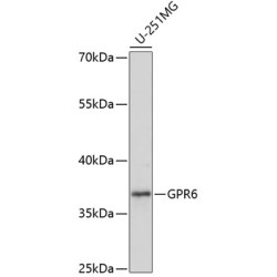 GPR6 Rabbit pAb