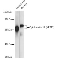 Cytokeratin 12 (KRT12) Rabbit pAb