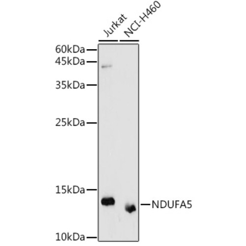 NDUFA5 Rabbit pAb