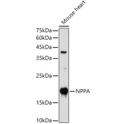 NPPA Rabbit pAb