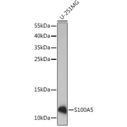 S100A5 Rabbit pAb