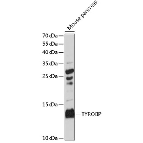 TYROBP Rabbit pAb