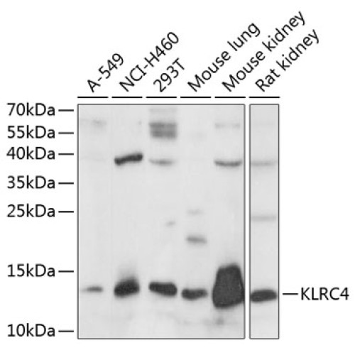 KLRC4 Rabbit pAb
