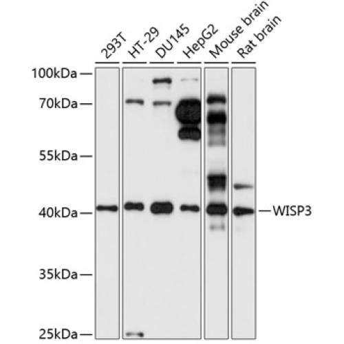 WISP3 Rabbit pAb