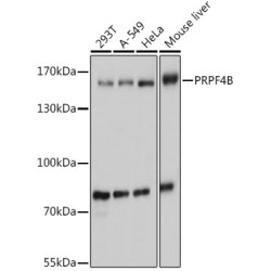 PRPF4B Rabbit pAb