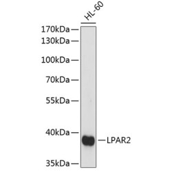 LPAR2 Rabbit pAb