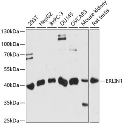 ERLIN1 Rabbit pAb