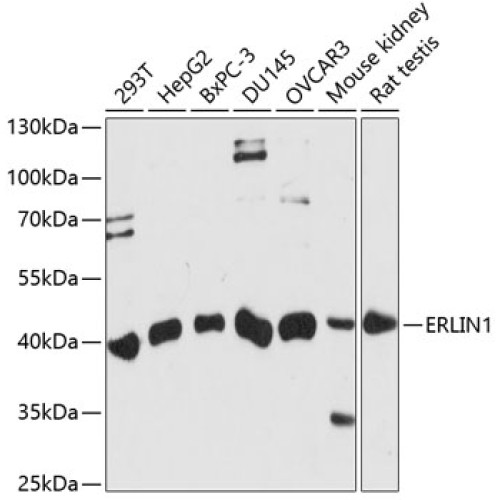ERLIN1 Rabbit pAb