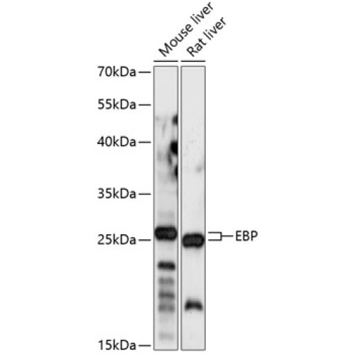 EBP Rabbit pAb