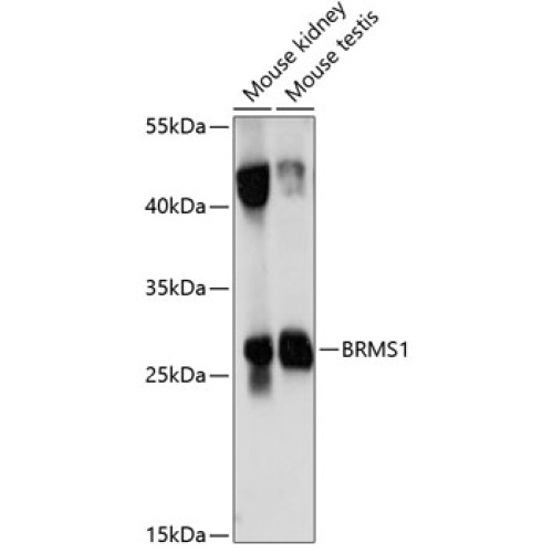 BRMS1 Rabbit pAb