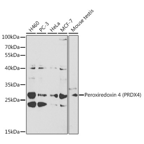 [KO Validated] Peroxiredoxin 4 (PRDX4) Rabbit pAb